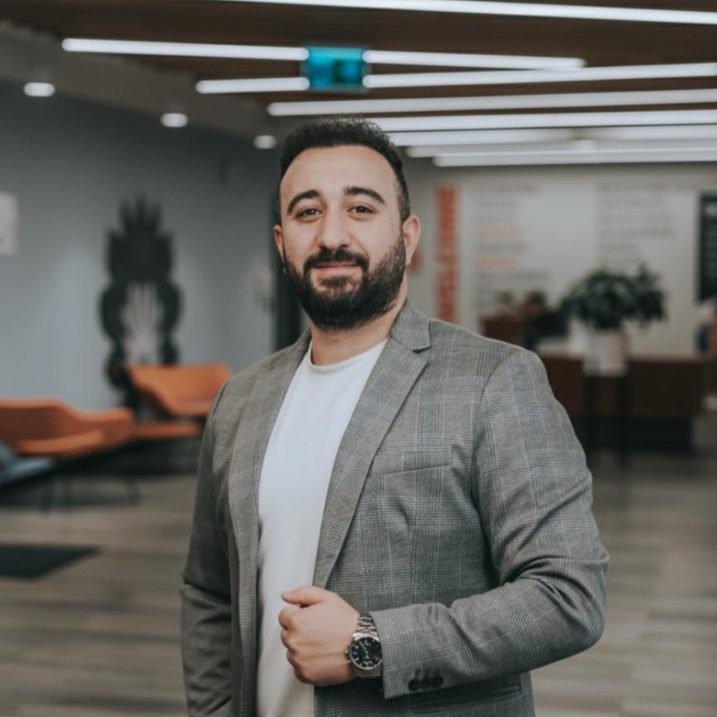 Dorukcan after his hair transplant