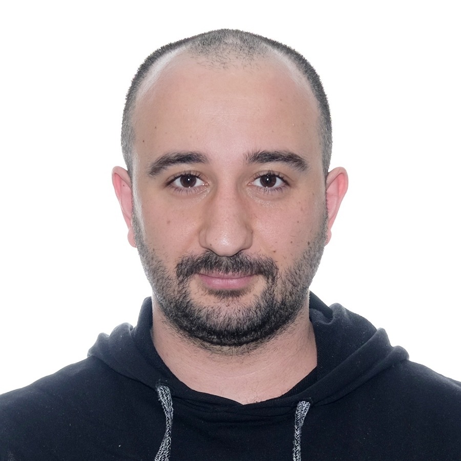 Dorukcan before his hair transplant